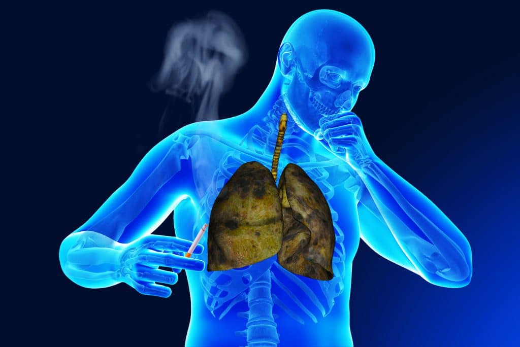 Можно ли курить при пневмонии