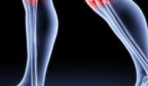 Боль в коленном суставе: причины и лечение патологии