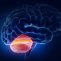 Инсульт мозжечка головного мозга: последствия