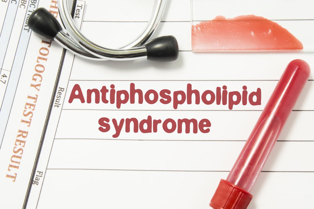 Антифосфолипидный синдром клиника диагностика лечение thumbnail