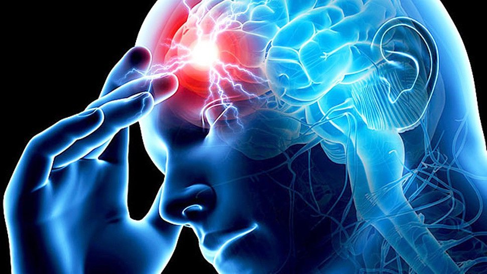 Инсульт головного мозга, его признаки, реабилитация и лечение