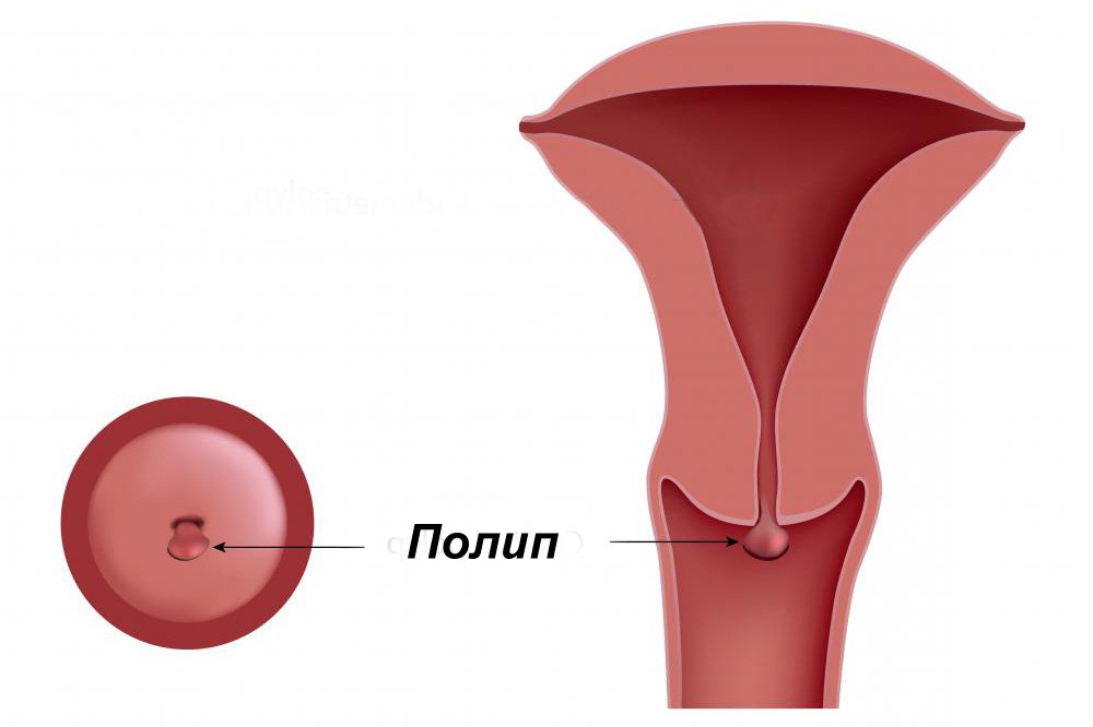 Как устроена женская репродуктивная система - Remedi
