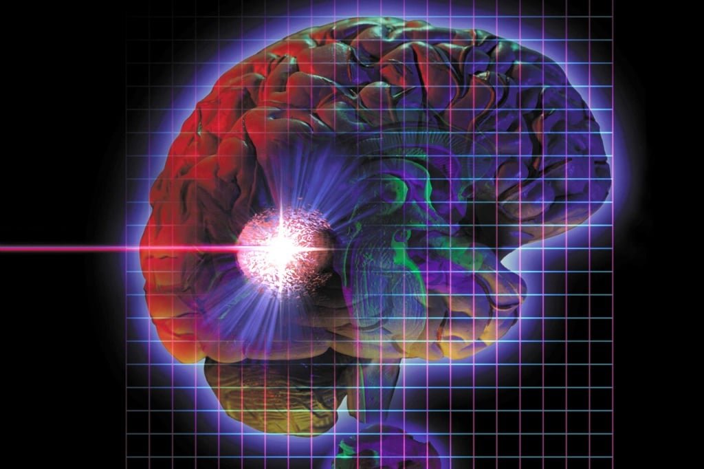 Диагностика опухолей головного мозга: основные методы