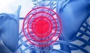 Остеохондроз грудного отдела позвоночника: симптомы и лечение