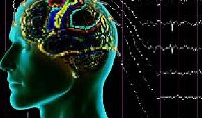 Расшифровка показателей ЭЭГ головного мозга