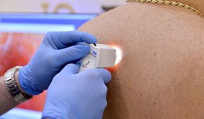 Фиброма кожи: фото новообразования