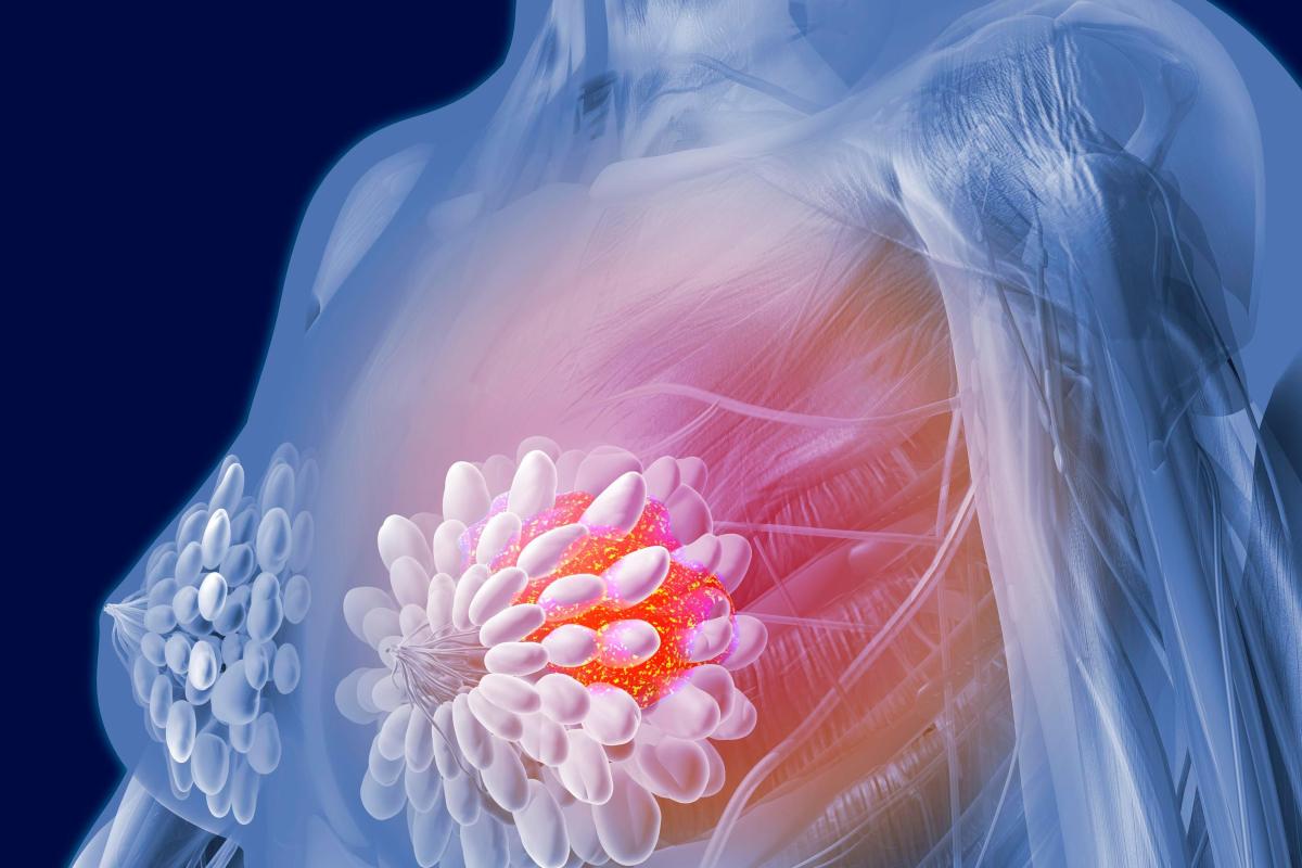 Не бывает дня, чтобы я не читала про свою болезнь»: история принятия и лечения рака груди