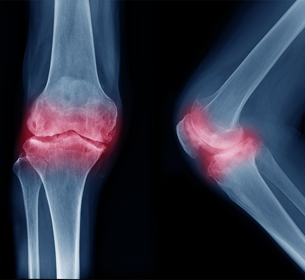 Причины боли в колене: заболевания и симптомы