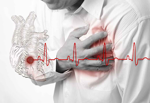 ишемическая болезнь сердца лечение