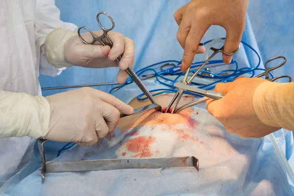 абдоминальная хирургия москва